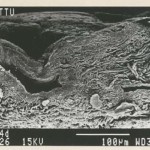 Ill. 3. Rasvade eemaldamine on aga raskendatud juhul, kui ei eemaldata täielikult derma pindmist kihti (ingl grain layer) koos seda kihti läbivate karvaaukudega, mis moodustavad pinna lähedases alas raskesti puhastatavaid süvendeid. Foto on tehtud Tallinna tehnikaülikooli materjaliuuringute teaduskeskuses.