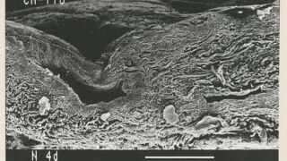 Ill. 3. Rasvade eemaldamine on aga raskendatud juhul, kui ei eemaldata täielikult derma pindmist kihti (ingl grain layer) koos seda kihti läbivate karvaaukudega, mis moodustavad pinna lähedases alas raskesti puhastatavaid süvendeid. Foto on tehtud Tallinna tehnikaülikooli materjaliuuringute teaduskeskuses.</ br>
However, the removal of fats is more difficult if the surface layer of the dermis (English grain layer) is not completely removed along with the hair holes passing through this layer, which form pits that are difficult to clean in the area near the surface. The photo was taken at the Materials Research Center of Tallinn University of Technology.